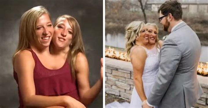 Abby and Brittany Hensel Latest News: A Look at Their Remarkable Journey and Recent Revelations