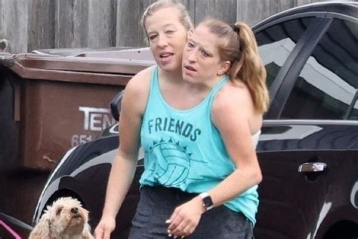 Abby and Brittany Hensel Sad News: Unpacking the Latest Buzz and What It Really Means