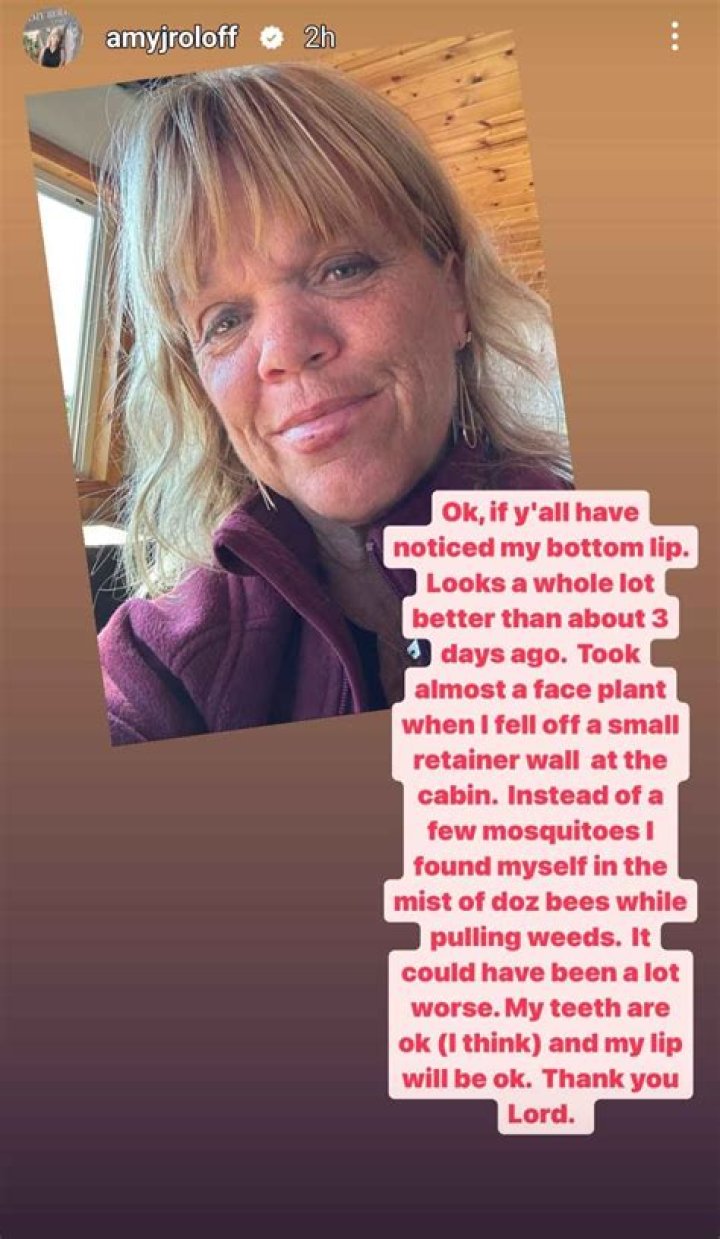 Amy Roloff Accident: Getting the Facts Straight