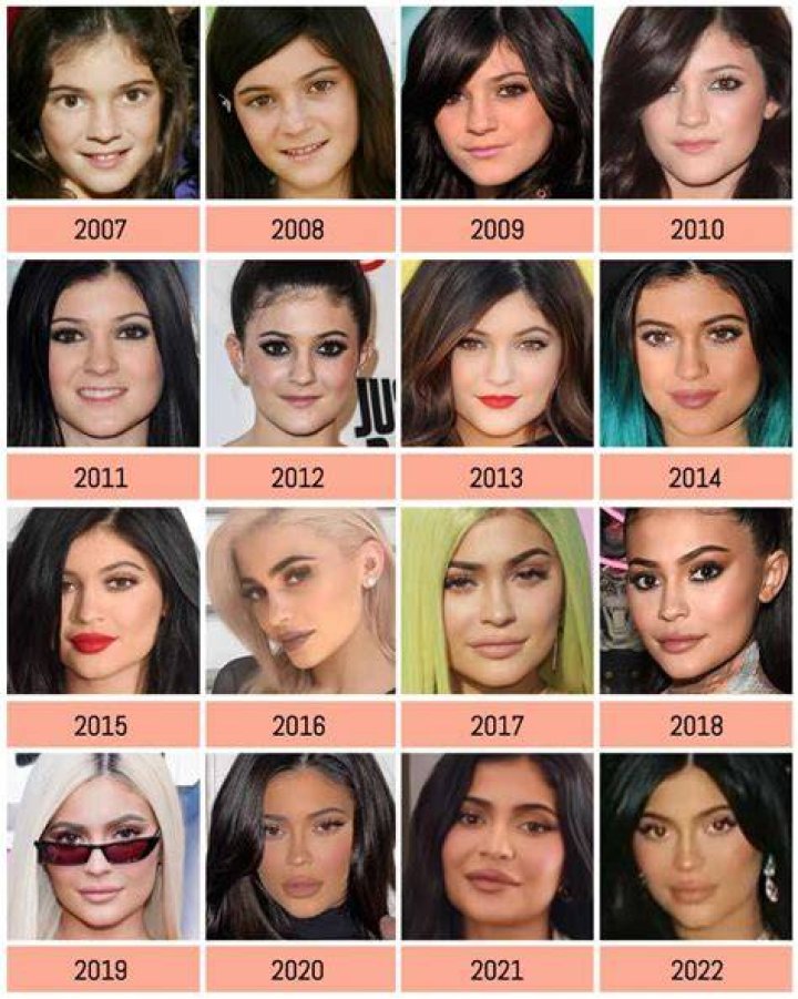 At What Age Did Kylie Get Surgery? Unpacking the Public Timeline