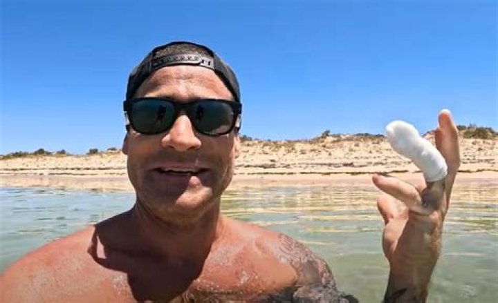Brodie Moss Finger Bite: Unpacking the Viral Moment and What It Means