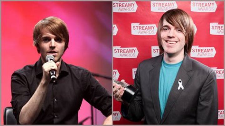 Did Shane Dawson Have Surgery? Unpacking the Public Discussion