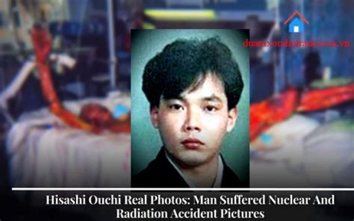 Discovering the Truth: Hisashi Ouchi Photos Real or Fake?