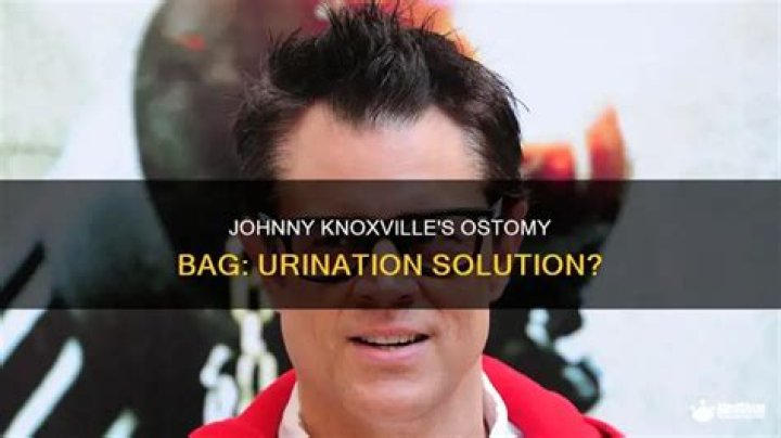 Does Johnny Knoxville Still Need a Catheter? Unpacking His Stunt Injuries