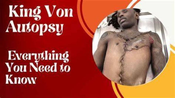 Exploring the King Von Autopsy Photo: Understanding the Impact and Controversy