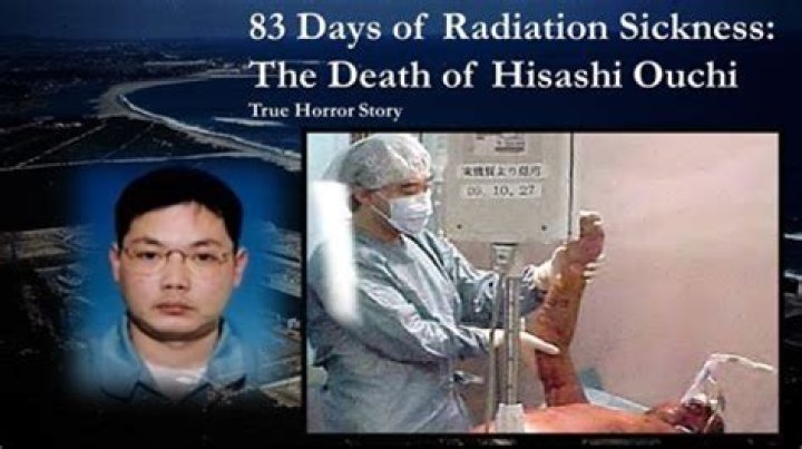 Hisashi Ouchi Photos Real: Unveiling the Truth Behind the Infamous Incident