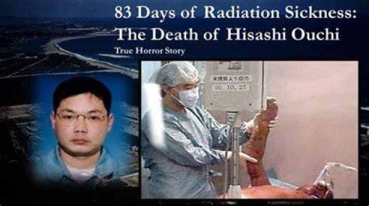 Hisashi Ouchi: The Tragic Story Behind the Real Photos