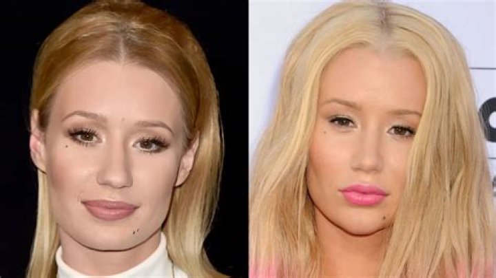 How Much Surgery Has Iggy Azalea Had? Exploring Public Perceptions