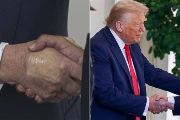 Is Donald Trump Right Handed? Exploring the Hand Preference of a Prominent Figure