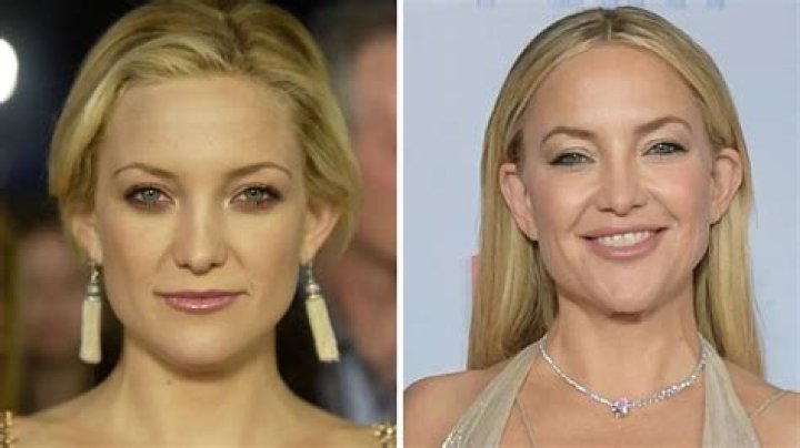 Kate Hudson: A Look at Her Life, Career, and What Makes Her Sparkle