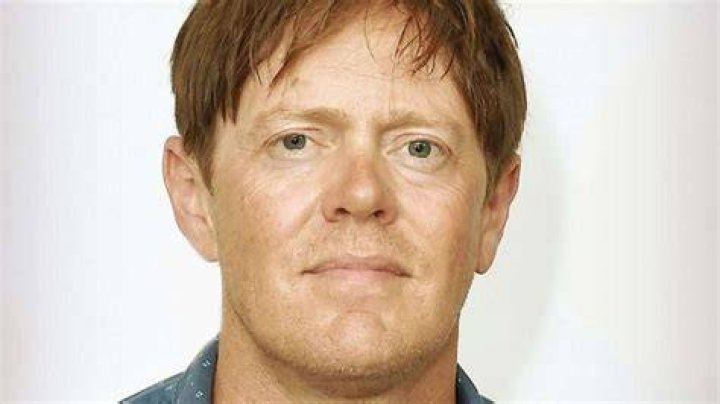 Kris Marshall Face Surgery: Unpacking the Whispers and What We Know
