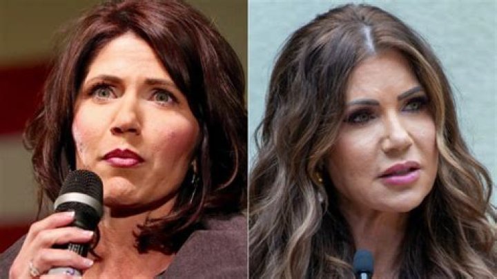 Kristi Noem Lips Before and After: A Comprehensive Look at the Transformation