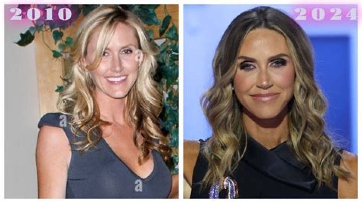 Lara Trump Plastic Surgery: Unveiling the Facts and Debunking the Myths