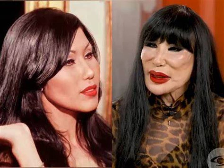 Lyn May Face Incident: The Untold Story and Controversies