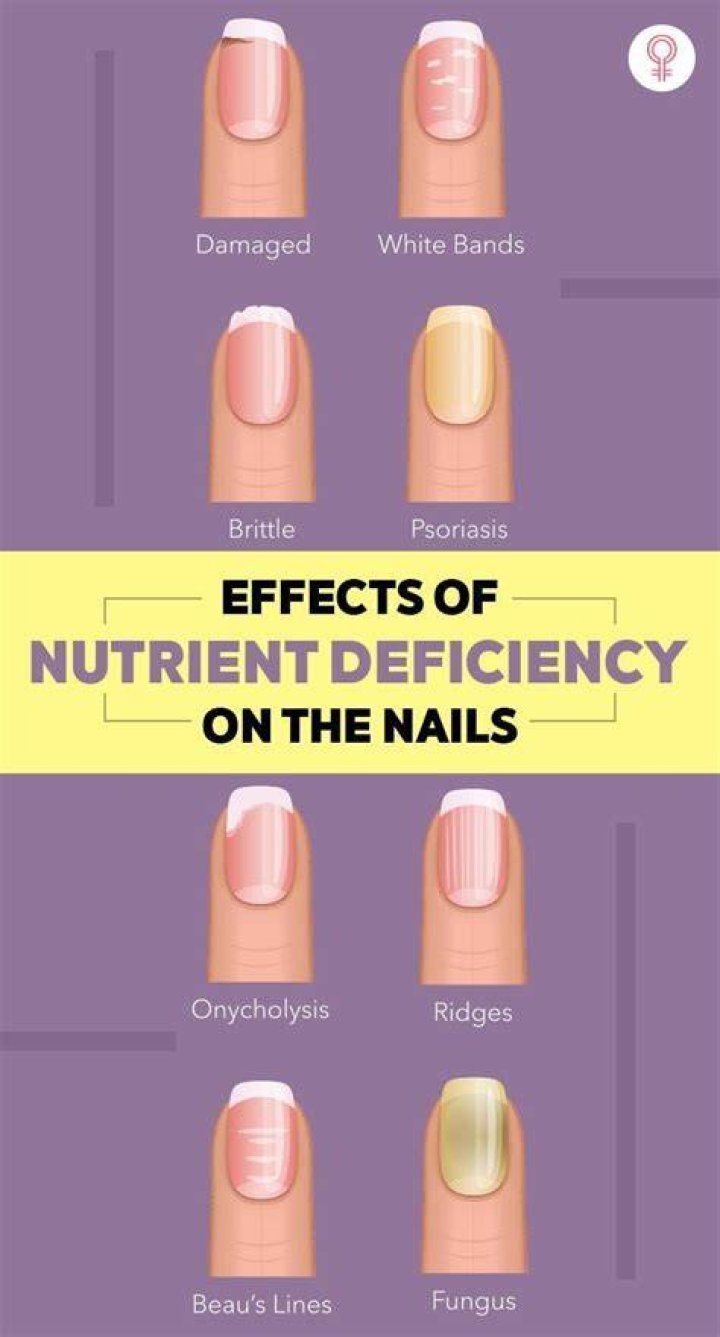 Ridged Fingernails Vitamin Deficiency: What You Need to Know