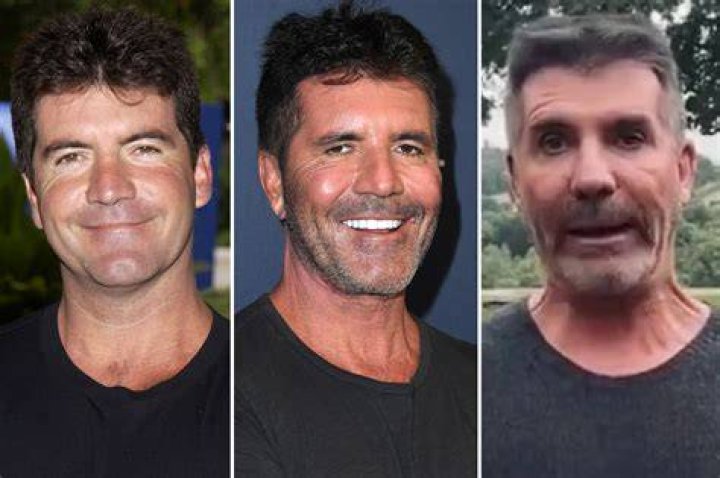 Simon Cowell Health: A Look at His Well-Being Journey