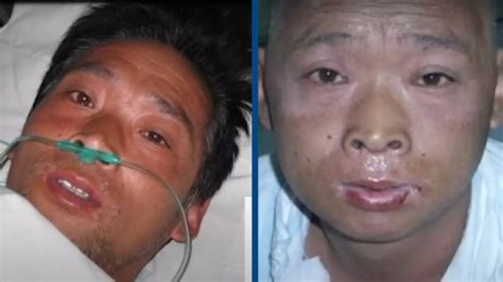 The Haunting Glimpse: Unpacking the Hisashi Ouchi Photo and Its Lasting Impact