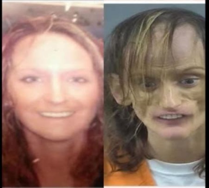 The Inspiring Recovery of Misty Lomab: From Viral Mugshot to Hope
