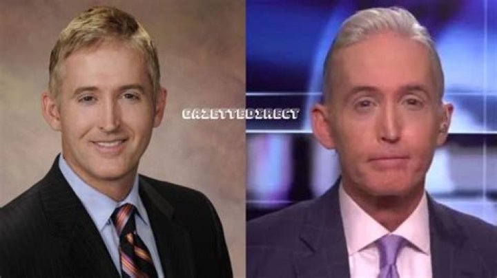 Trey Gowdy Before Nose Job: What the Public Has Been Curious About
