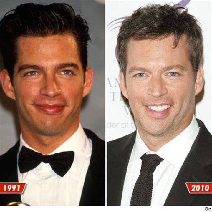 Understanding Harry Connick Jr.'s Stroke: A Deep Dive into His Health Journey and Recovery