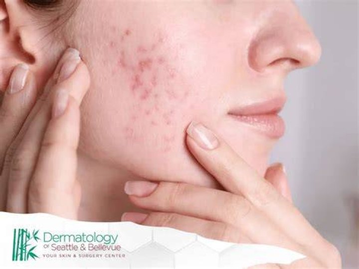 Understanding the Buzz Around scars.wonderland leaked: What You Should Know
