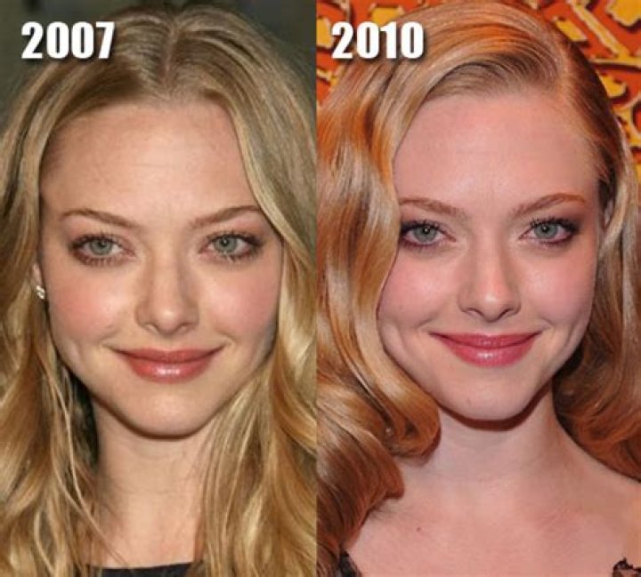 Unraveling the Speculation: Did Amanda Seyfried Have Plastic Surgery?