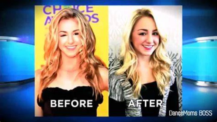 What Condition Does Chloe Lukasiak Have? Unveiling Her Health Journey
