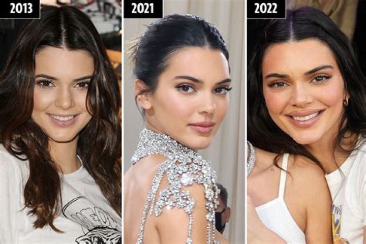 What Did Kendall Jenner Do to Her Lips? Unpacking the Public Fascination