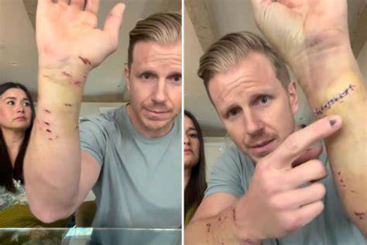 What Happened to the Dog That Bit Sean Lowe? Unpacking the Story
