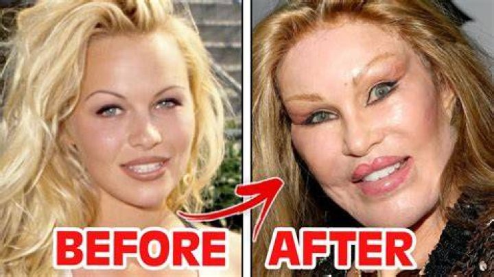Which Actress Hasn't Done Plastic Surgery?