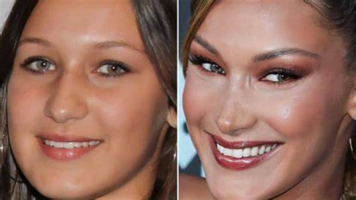 Which Celebrity Has Had the Most Plastic Surgery? Exploring Transformations in the Spotlight