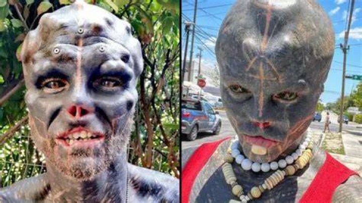 Who is the Black Alien Guy? Exploring the Man Behind the Transformation and Hypothetical Health Considerations