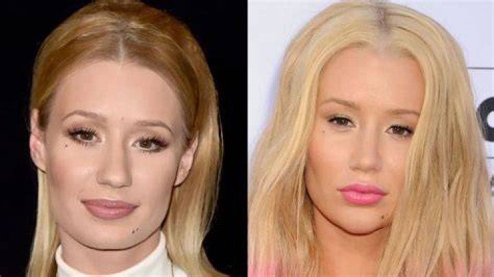 Why Did Iggy Azalea Join OnlyFans? Unpacking a Star's Bold Move