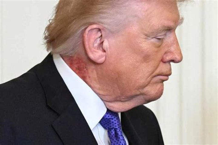 Why is Donald Trump's Skin Orange? Unpacking a Common Public Observation